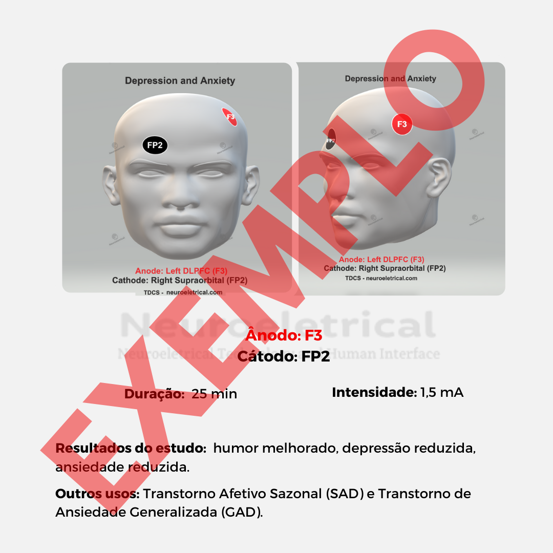 Protocolos de Posicionamento TDCS/ETCC (arquivo digital)
